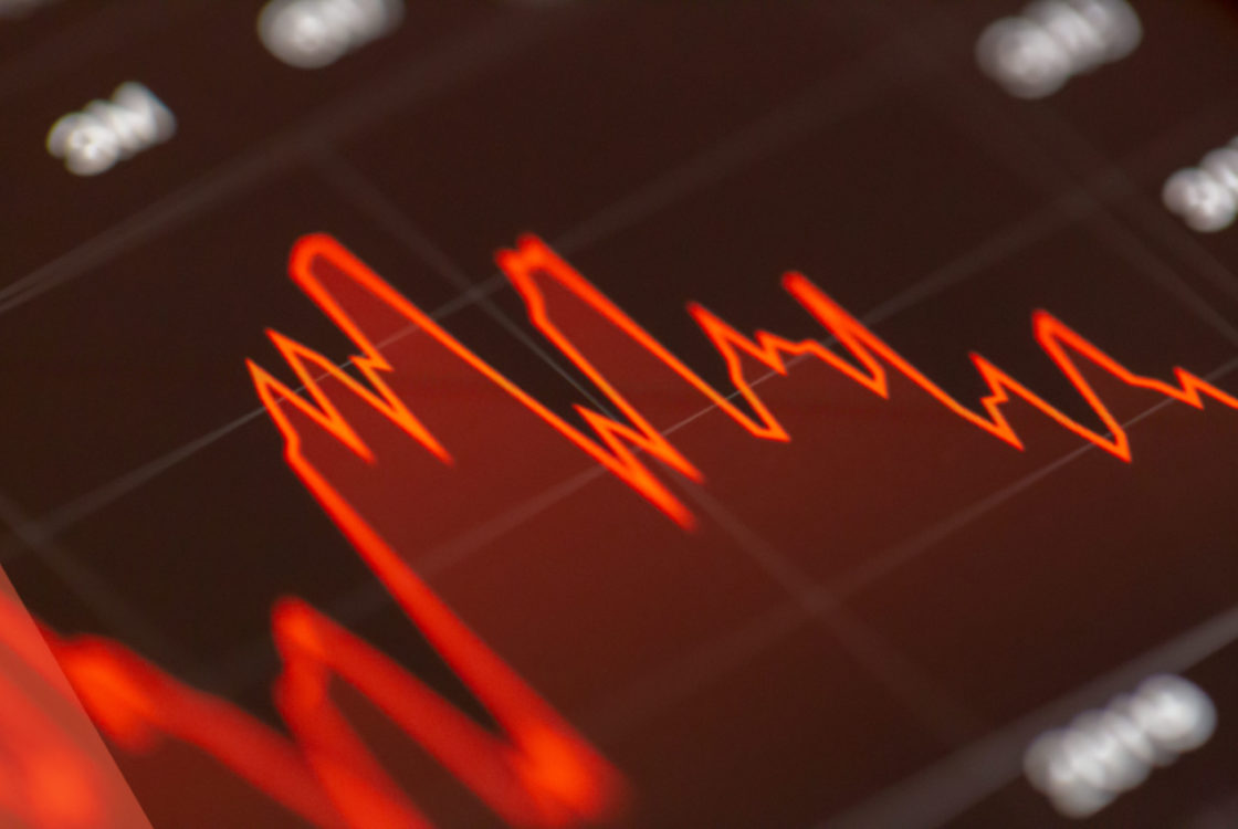 What Are Google s Core Web Vitals User Experience SEO
